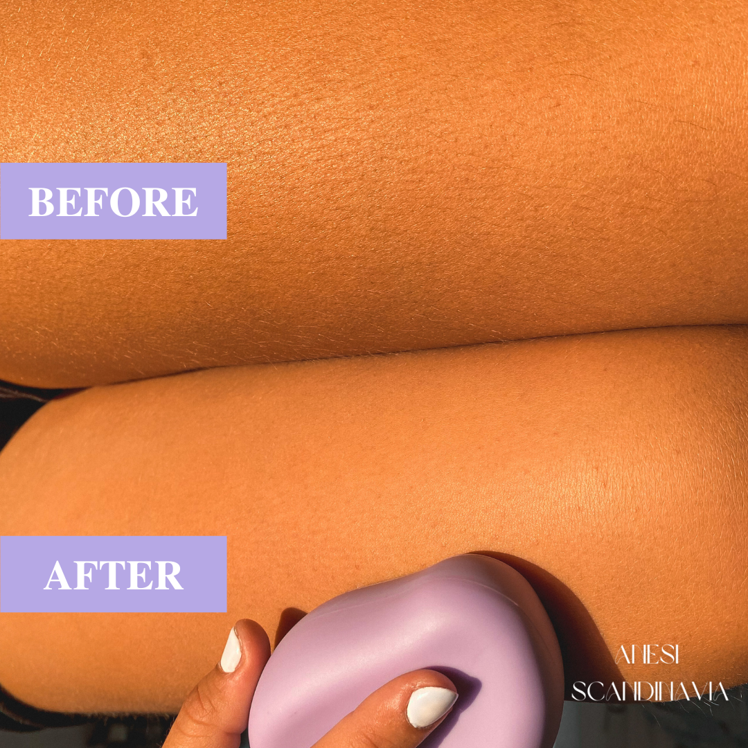 HÈSTIA™ Pain-Free Hair Remover 1+1